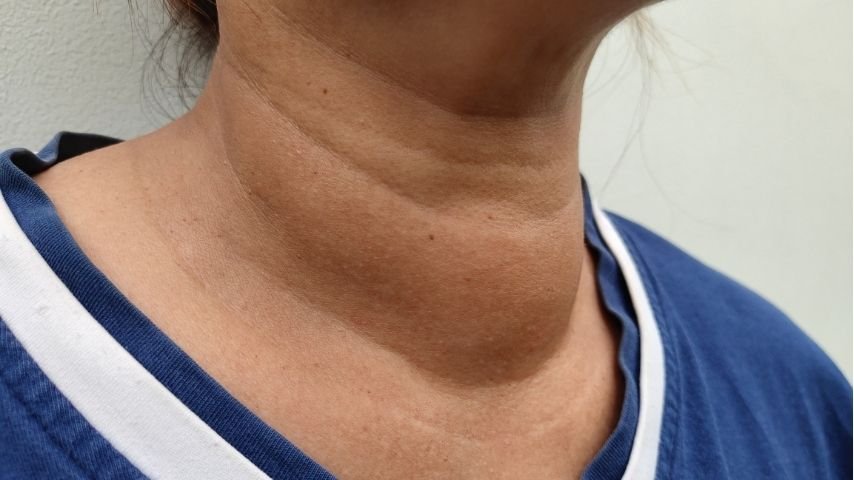 Why Is My Neck Swelling Getting Bigger- Could It Be a Goiter Why Is My Neck Swelling Getting Bigger- Could It Be a Goiter