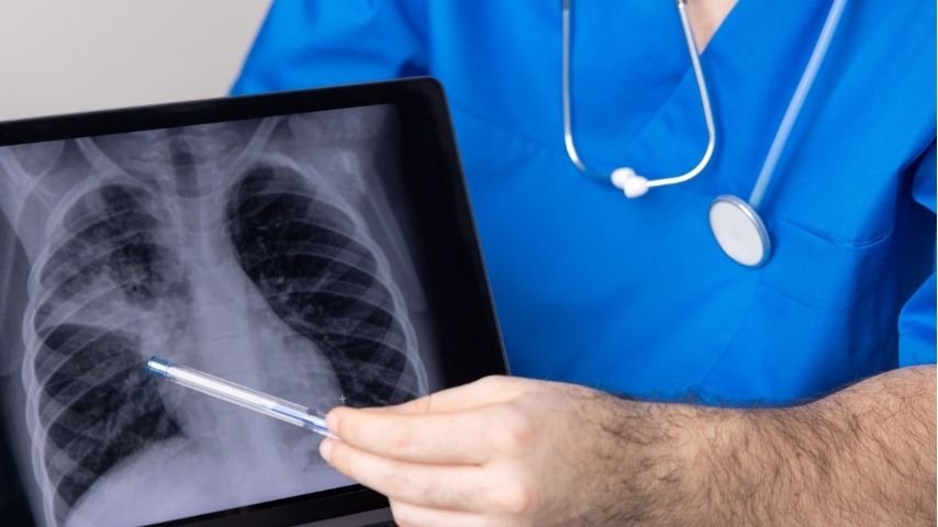 Thoracentesis Recovery Timeline- What Happens After the Procedure