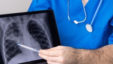 Thoracentesis Recovery Timeline- What Happens After the Procedure Thoracentesis Recovery Timeline- What Happens After the Procedure