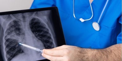 Thoracentesis Recovery Timeline- What Happens After the Procedure Thoracentesis Recovery Timeline- What Happens After the Procedure