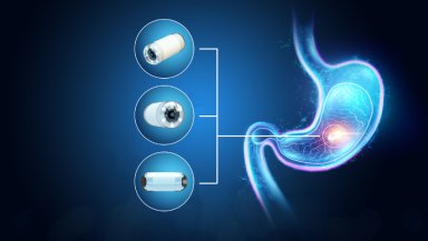 Is Capsule Endoscopy Safe-Understanding the Real Risk of Capsule Retention Is Capsule Endoscopy Safe-Understanding the Real Risk of Capsule Retention