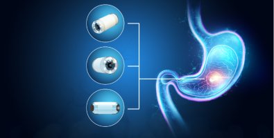 Is Capsule Endoscopy Safe-Understanding the Real Risk of Capsule Retention Is Capsule Endoscopy Safe-Understanding the Real Risk of Capsule Retention