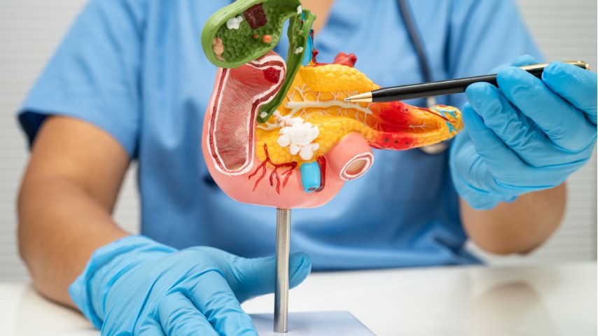 Signs Your Bile Duct May Be Blocked- When Palliative Biliary Stenting Becomes Necessary Signs Your Bile Duct May Be Blocked- When Palliative Biliary Stenting Becomes Necessary