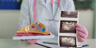 Why Sarcoma Is Often Misdiagnosed Before Surgery — And How That Affects Outcomes Why Sarcoma Is Often Misdiagnosed Before Surgery — And How That Affects Outcomes