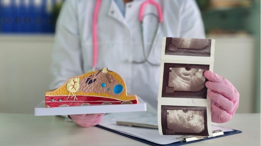 Why Sarcoma Is Often Misdiagnosed Before Surgery — And How That Affects Outcomes Why Sarcoma Is Often Misdiagnosed Before Surgery — And How That Affects Outcomes