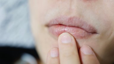 Dry Mouth Causes: Symptoms, Treatment, and Best Ways to Improve Oral Moisture Naturally Dry Mouth Causes: Symptoms, Treatment, and Best Ways to Improve Oral Moisture Naturally