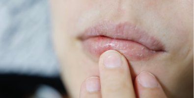 Dry Mouth Causes: Symptoms, Treatment, and Best Ways to Improve Oral Moisture Naturally Dry Mouth Causes: Symptoms, Treatment, and Best Ways to Improve Oral Moisture Naturally