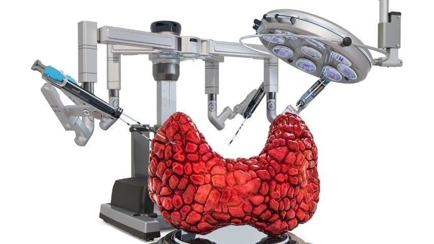 Am I Eligible for Robotic Thyroidectomy or Is My Doctor Right to Say No