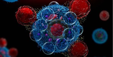 CAR-T Therapy Breakthroughs- How This Treatment Is Changing Cancer Care in 2026 CAR-T Therapy Breakthroughs- How This Treatment Is Changing Cancer Care in 2026