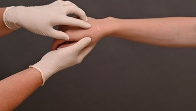 Recovery After Microvascular Free Flap Reconstruction-A Week-by-Week Guide Recovery After Microvascular Free Flap Reconstruction-A Week-by-Week Guide