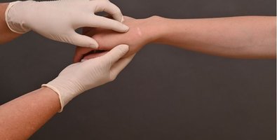 Recovery After Microvascular Free Flap Reconstruction-A Week-by-Week Guide Recovery After Microvascular Free Flap Reconstruction-A Week-by-Week Guide