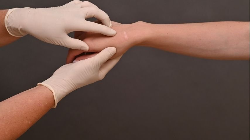 Recovery After Microvascular Free Flap Reconstruction-A Week-by-Week Guide Recovery After Microvascular Free Flap Reconstruction-A Week-by-Week Guide