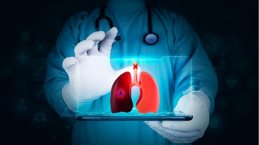 What Is a Bronchoscopic Lung Nodule Biopsy- A Simple Guide for Patients