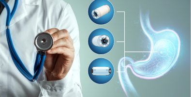 Should You Choose Capsule Endoscopy- A Gastroenterologist Answers the Most Common Patient Questions Should You Choose Capsule Endoscopy- A Gastroenterologist Answers the Most Common Patient Questions