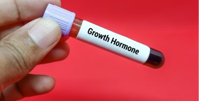 Is There a Best Age to Start Treatment for Short Stature- Why Timing Matters for Growth Outcomes Is There a Best Age to Start Treatment for Short Stature- Why Timing Matters for Growth Outcomes