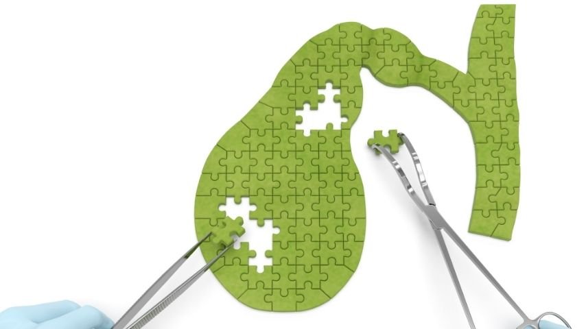 Diet and Lifestyle After Gallbladder Removal-Real Advice for Long-Term Wellness Diet and Lifestyle After Gallbladder Removal-Real Advice for Long-Term Wellness