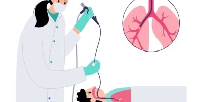 Why Do Some Airway Conditions Require a Stent-Understanding Severe Airway Narrowing Why Do Some Airway Conditions Require a Stent-Understanding Severe Airway Narrowing