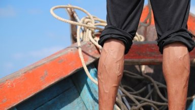 Will Varicocele Embolization Improve Fertility- What Real Outcomes Show Will Varicocele Embolization Improve Fertility- What Real Outcomes Show