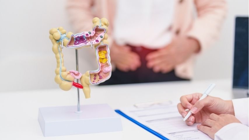How to Choose the Right Colorectal Surgeon-10 Questions to Ask Before Your Operation