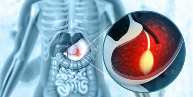 Common Digestive Symptoms That May Need an Endoscopy Common Digestive Symptoms That May Need an Endoscopy