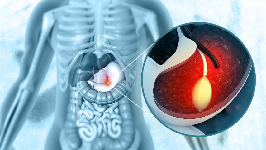 Common Digestive Symptoms That May Need an Endoscopy Common Digestive Symptoms That May Need an Endoscopy