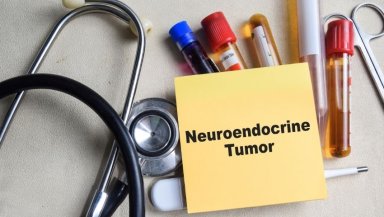 How Does Lu-177 Dotatate Work in the Body-Explained here How Does Lu-177 Dotatate Work in the Body-Explained here