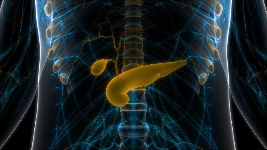 Pancreatic Leak After Distal Pancreatectomy- Warning Signs Patients Should Never Ignore