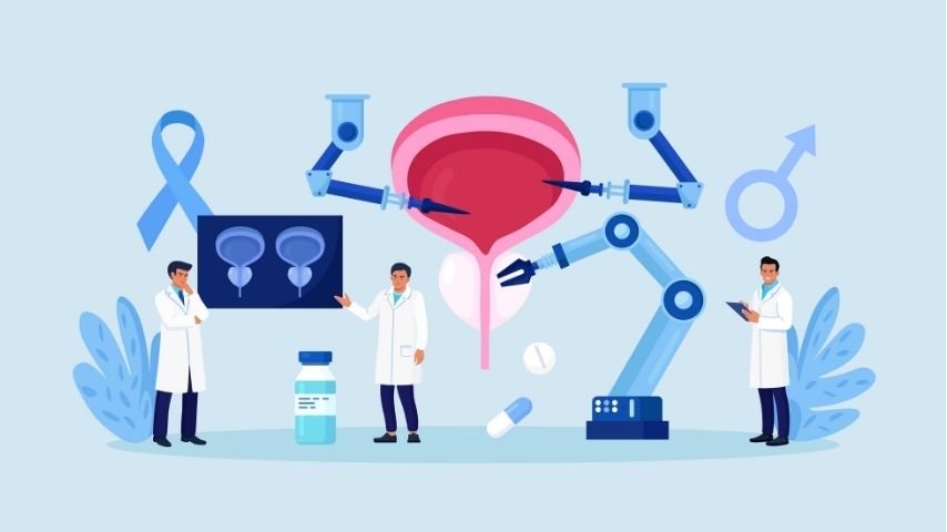 Choosing the Right Cancer Center for SBRT What Patients Regret Not Checking Choosing the Right Cancer Center for SBRT What Patients Regret Not Checking