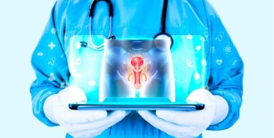 Is Varicocele Embolization Safe- Risks, Complications, and Success Rates Is Varicocele Embolization Safe- Risks, Complications, and Success Rates