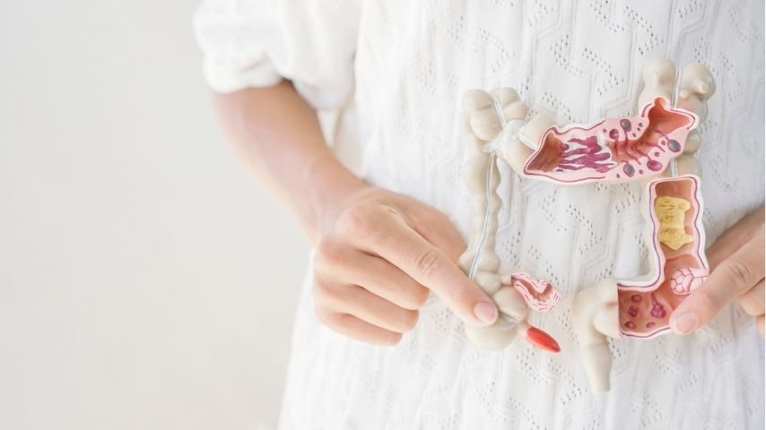 Will I Need a Colostomy or Ileostomy- What Determines Whether a Stoma Is Temporary or Permanent Will I Need a Colostomy or Ileostomy- What Determines Whether a Stoma Is Temporary or Permanent