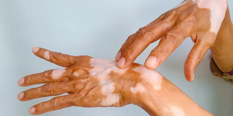 Specialised Dermatology Care