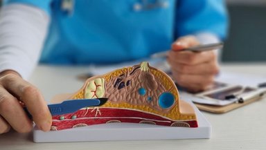 How to Manage Pain and Physical Therapy After Modified Radical Mastectomy How to Manage Pain and Physical Therapy After Modified Radical Mastectomy