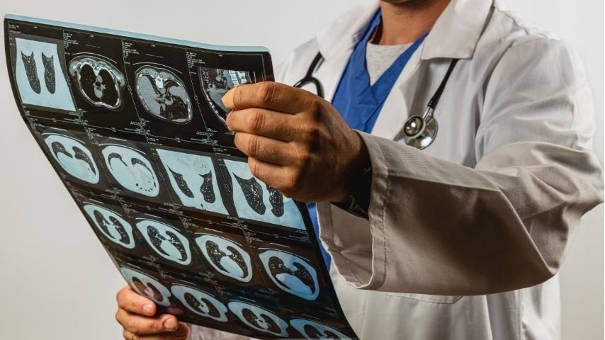 Thoracentesis vs Pleural Effusion- Understanding the Connection