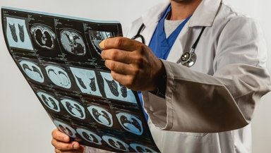 Thoracentesis vs Pleural Effusion- Understanding the Connection Thoracentesis vs Pleural Effusion- Understanding the Connection