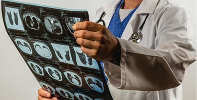 Thoracentesis vs Pleural Effusion- Understanding the Connection Thoracentesis vs Pleural Effusion- Understanding the Connection