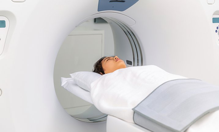 Monitoring a brain aneurysm via a Magnetic Resonance Imaging (MRI) scan. brain-aneurysm-monitoring