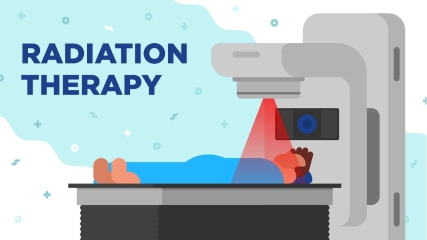 SBRT Side Effects-Short-Term vs Long-Term Risks Explained by Experts