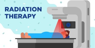 SBRT Side Effects-Short-Term vs Long-Term Risks Explained by Experts SBRT Side Effects-Short-Term vs Long-Term Risks Explained by Experts