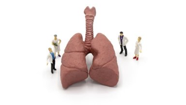 What Is the Recovery Timeline After a Lung Transplant-ICU, Hospital Stay & First 6 Months Explained What Is the Recovery Timeline After a Lung Transplant-ICU, Hospital Stay & First 6 Months Explained