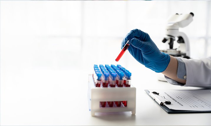 What is cancer screening What is cancer screening