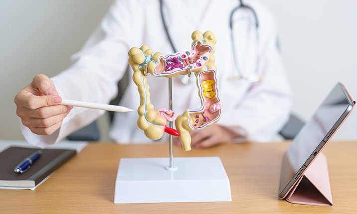How often to do colonoscopy How often to do colonoscopy
