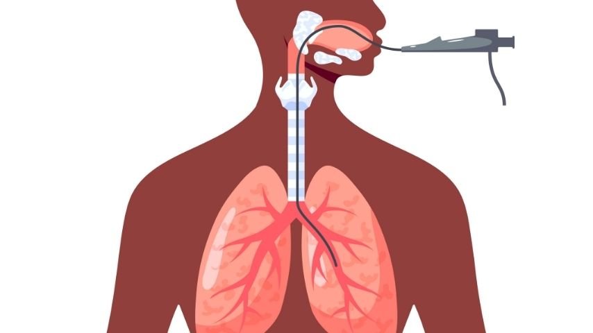 Why Tumors, Scar Tissue, or Infections Can Narrow the Windpipe