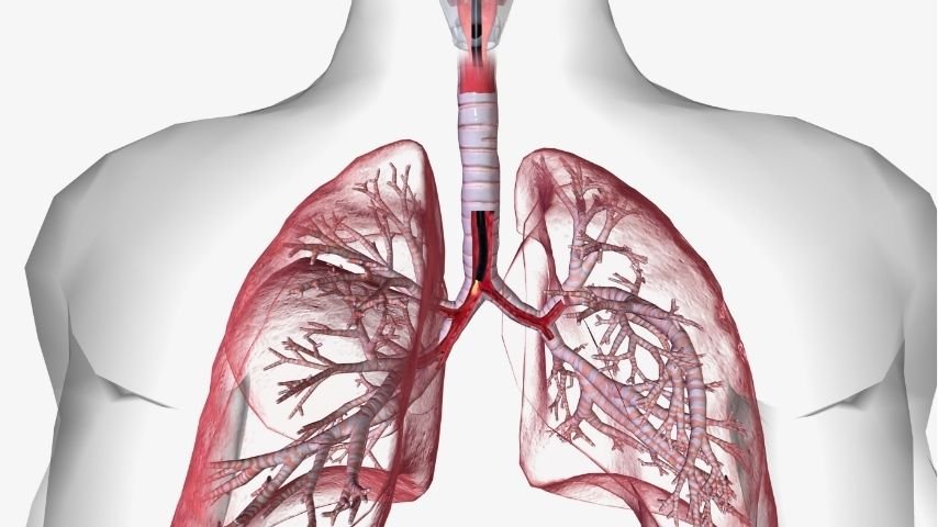 How Long Does a Tracheal Stent Stay In-When Doctors Remove or Replace It