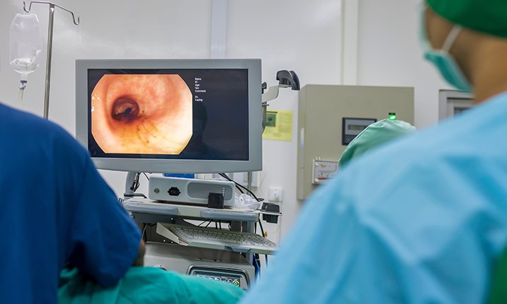 colonoscopy or gastroscopy inside operating theatre in the hospital - intext image