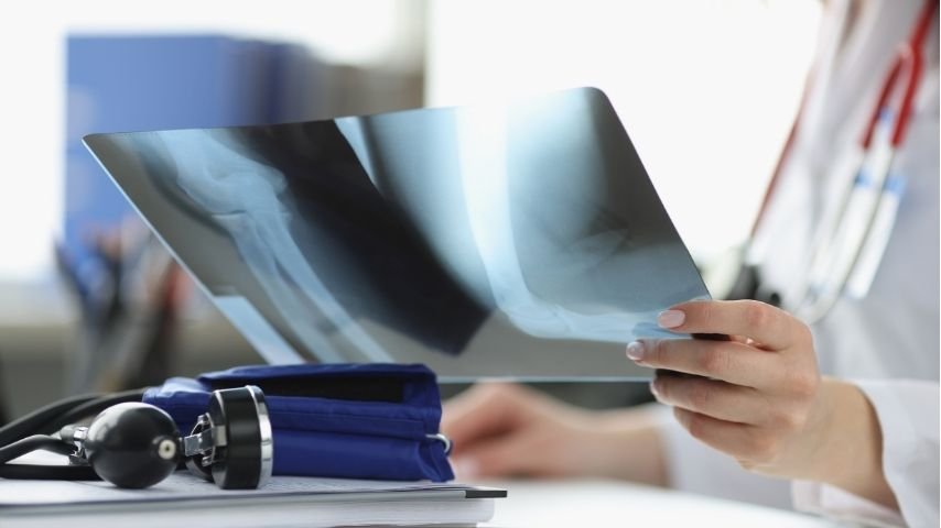 Cost of Revision Hip and Knee Replacement- What Patients and Families Should Expect Cost of Revision Hip and Knee Replacement- What Patients and Families Should Expect