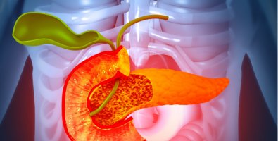 Laparoscopic vs Open Distal Pancreatectomy- Which Recovery Is Better Laparoscopic vs Open Distal Pancreatectomy- Which Recovery Is Better