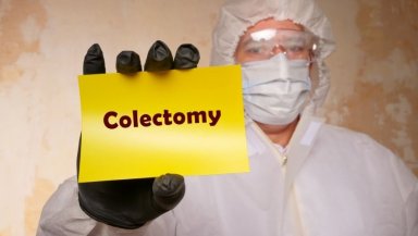 What Is Colon Surgery and When Do Doctors Recommend It- A Simple Guide What Is Colon Surgery and When Do Doctors Recommend It- A Simple Guide