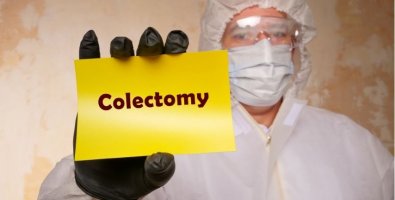 What Is Colon Surgery and When Do Doctors Recommend It- A Simple Guide What Is Colon Surgery and When Do Doctors Recommend It- A Simple Guide