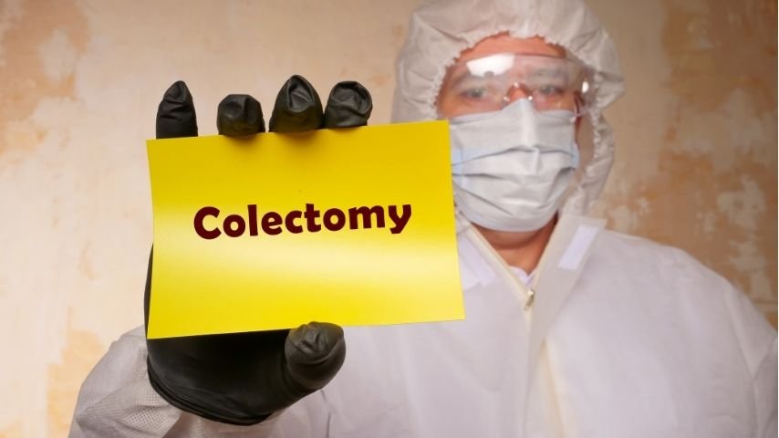 What Is Colon Surgery and When Do Doctors Recommend It- A Simple Guide What Is Colon Surgery and When Do Doctors Recommend It- A Simple Guide