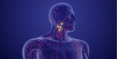 Sarcoidosis, Lymphoma, or Infection- Why Mediastinal Lymph Nodes Need Tissue Diagnosis Sarcoidosis, Lymphoma, or Infection- Why Mediastinal Lymph Nodes Need Tissue Diagnosis